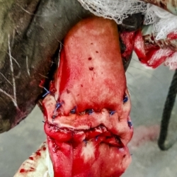 Tongue Laceration, after